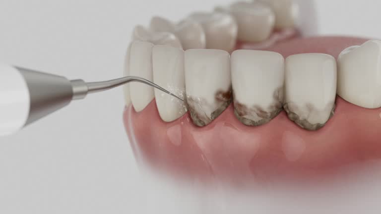 Reliable Emergency Dentist contractor in Everson, WA by Smile Center Dentistry